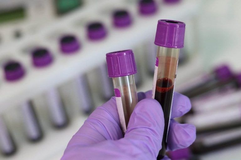 Poland will apply rapid tests for coronavirus